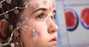 Epilepsiya kakie priznaki dolzhny nastorozhit roditelej rebenka