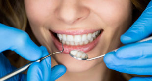 Виды имплантов для зубов