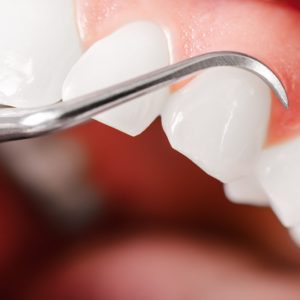 Как сохранить зубы и десна в хорошем состоянии
